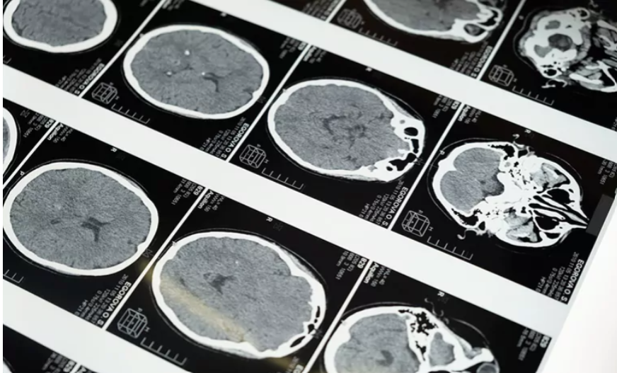 Imagen representativa de el hallazgo de un patrón